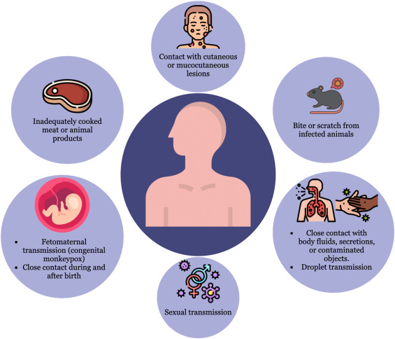 Monkeypox Cases Rising in 2024: Symptoms, Prevention & Latest Updates Monkeypox Cases Rising in 2024: Symptoms, Prevention & Latest Updates